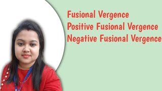 FUSIONAL VERGENCE  POSITIVE AND NEGATIVE FUSIONAL VERGENCE [upl. by Aiyotal404]