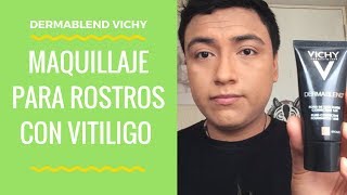 TUTORIAL Maquillaje para VITILIGO dermablend para rostro [upl. by Alderson]