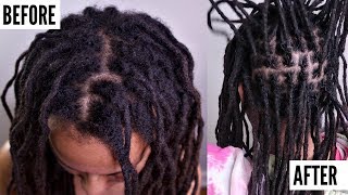 ALL About INTERLOCKING Locs  Does It Cause THINNING  Dreadlock QampA [upl. by Lerred125]