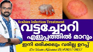 വട്ടച്ചോറി മാറാൻ  Vattachori Maran  Scabies infection CausesSymptomsTreatment  DrVisakhKadakkal [upl. by Ecinaj]