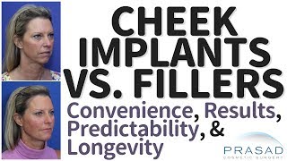 Cheek Implants Vs Fillers  Factors of Patient Convenience Results Predictability and Longevity [upl. by Verger]