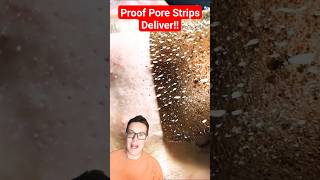 PROOF PORE STRIPS WORK  Phenomenal Pore Strip Removal shorts [upl. by Anec]