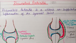 Rheumatoid Arthritis [upl. by Nimref]