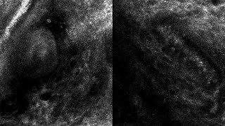 Adherent and Rolling Leukocytes in Intact Cutaneous Microvasculature via Confocal Videomicroscopy [upl. by Atrahc701]