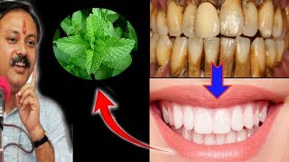 Magical Teeth whitening home remedy get whitening teeth at home in 5 minutes [upl. by Kciredor677]