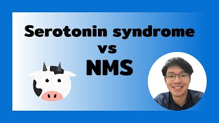 Serotonin syndrome vs Neuroleptic malignant syndromeNMS [upl. by Nodle647]