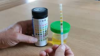 How to use urine test strips 10 parameters [upl. by Ahsik]