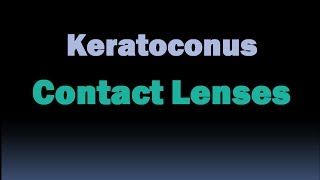 Contact lenses for Keratoconus Sclera lenses hybrid lenses RGP contact lenses  Piggybacking [upl. by Hepsiba]