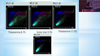 Automated FRC Count in Mindray BC6200  Effect of Microcytosis and Poikilocytosis [upl. by Jeanie383]