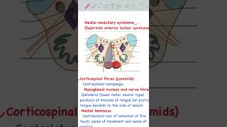 Medial Medullary Syndrome usmlestep usmlepreparation usmlestep1 [upl. by Lraed80]