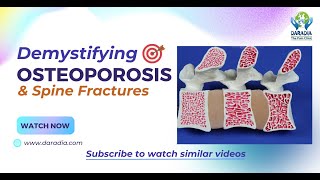 🦴📚Latest Osteoporosis Treatment amp Spine Fractures What a Physician Must Know👨‍⚕️🦴 [upl. by Lennod5]