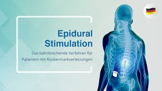 Epidural Stimulation Das bahnbrechende Verfahren für Patienten mit Rückenmarkverletzungen [upl. by Burty357]