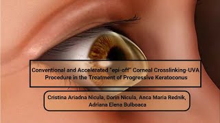 Conventional and Accelerated “epioff” Corneal CrosslinkingUVA Procedure in the Treatment [upl. by Napra]