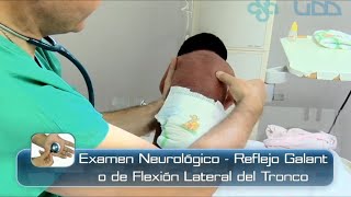 Babinski Reflex in Infants  Clinical Examination [upl. by Desberg]