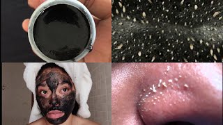 Masque au charbon contre les points blancs et imperfections du visage [upl. by Jazmin]