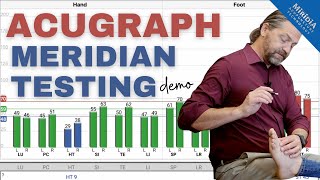 AcuGraph Meridian Testing  Graph Acupuncture Meridians with AcuGraph [upl. by Stallworth]