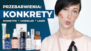 KONKRETY o PRZEBARWIENIACH Lista skutecznych kosmetyków  Cosmelan  laser na przebarwienia [upl. by Cadal74]