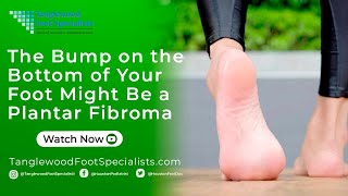 The Bump on the Bottom of Your Foot Might Be a Plantar Fibroma [upl. by Akinirt]