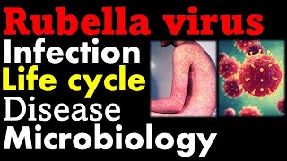 Rubella virus microbiology  infection pathology symptoms and replication cycle [upl. by Okram324]