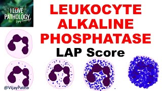 Leukocyte Alkaline Phosphatase LAP Score Principle Grading Applied aspects [upl. by Hgielek134]