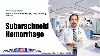 Subarachnoid Hemorrhage  Causes Diagnosis Symptoms Treatment Prognosis [upl. by Kikelia]