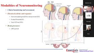 Neuromonitoring in ICU Prof M Amin 2024 Webinar [upl. by Gnof210]