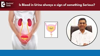 Why Is There Blood in My Urine Causes amp Treatments Explained  Dr Girish Nelivigi DoctorsCircle [upl. by Kiehl399]