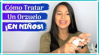 ¿Cómo curar un ORZUELO en NIÑOS  Cómo quitar un orzuelo rápido [upl. by Echikson]