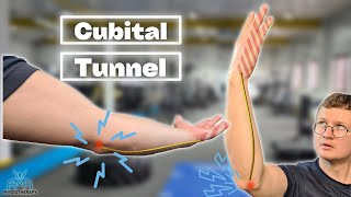 The BEST Exercises For Cubital Tunnel Syndrome [upl. by Cyrillus]