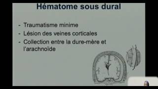 FMPM MOOCs  Exploration radiologique des traumatismes crâniens  Pr Idrissi [upl. by Cirdet956]