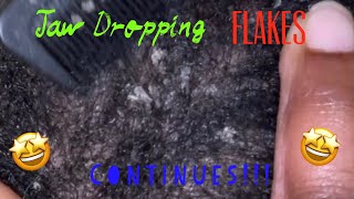 Jaw Dropping Flakes Continues  Scratchers Anonymous ASMR Jaw Dropping Flakes Continues [upl. by Ashleigh]