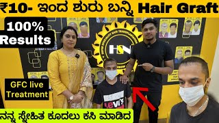 ₹10 BEST PRICE IN KARNATAKA FOR HAIR TRANSPLANT AND BEARD TRANSPLAT  HSN HAIR TRANSPLANT [upl. by Lrak]