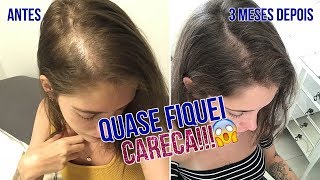 A VERDADE sobre o que aconteceu com o MEU CABELO 😢  Luiza Rossi [upl. by Irmgard222]