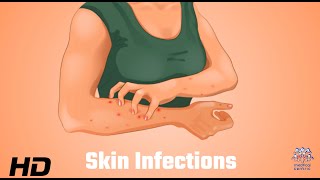 Skin Infections Uncovered What Your Dermatologist Wants You to Know [upl. by Birgitta]