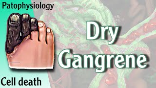 Dry Gangrene Necrosis شرح [upl. by Cattier]