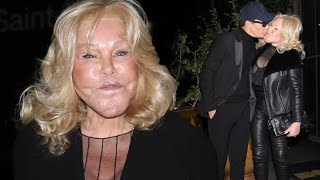 Jocelyn Wildenstein Catwoman dévoile un cliché delle jeune avant sa transformation cest choqu [upl. by Gio]