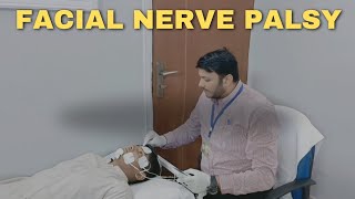 Facial Nerve Palsy [upl. by Lomax433]