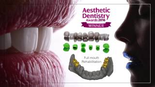 Casos premiados Dr Federico Brunner  Clínica dental Orión Madrid [upl. by Mouldon606]