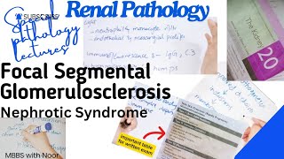 focal segmental glomerulosclerosis  nephrotic syndrome  renal pathology  selflessmedicose [upl. by Pirali882]