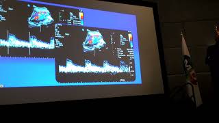 ECOGRAFÍA DOPPLER DE ARTERIAS RENALES [upl. by Showker459]