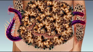 ASMR Deep cleaning 2d animation treaent How to removed dog ticks maggots worms infested bally178 [upl. by Ahsekad]