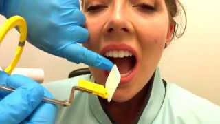 How to Take Periapical Radiographs [upl. by Amandi967]