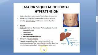 Pediatrics Portal Hypertension HepaticPulmonary Syndrome EHPVO PortoPulmonary PHTN Platypnea [upl. by Maillw]