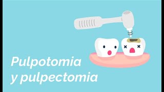 Diferencia entre pulpotomia u pulpectomia [upl. by Dlorrej334]