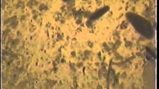 Rumen Video small protozoawmv [upl. by Enelav443]