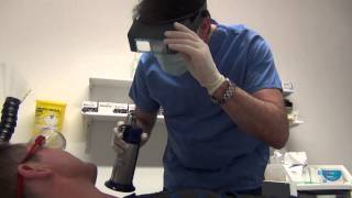 Cryotherapy treatment for skin [upl. by Bryan322]