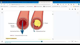 NUTRITION CHAPTER 19 CORONARY HEART DISEASE AND HYPERTENSION  PART 1 [upl. by Burd]