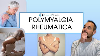 Polymyalgia Rheumatica  Signs and Symptoms of PMR [upl. by Stearn]