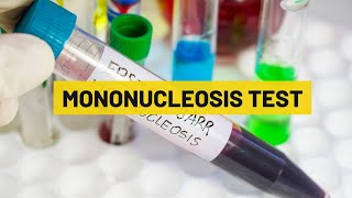 Mononucleosis Test  My Lab Solution [upl. by Jourdan596]