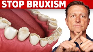 The Best 2 Remedies for Teeth Grinding Bruxism [upl. by Elleimac805]